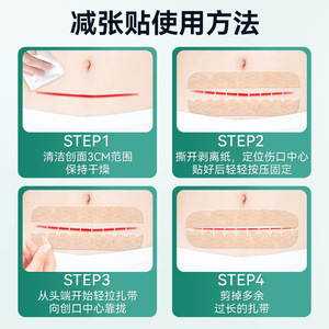 Pansement élastique tunnelisé réducteur de tension pour sutures cutanées, type fermeture éclair, pour pansement postopératoire sans suture, souple - Product Image 3