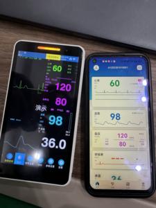 Peralatan medis rumah sakit, Monitor tekanan darah Neonatal kecil, peralatan dan perlengkapan medis - Product Image 4