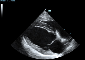 Mindray Vetus 7 Veterinario Cardíaco <span class=keywords><strong>Abdominal</strong></span> Veterinario Diagnóstico Color Doppler Sistema de imágenes de ultrasonido - Product Image 5