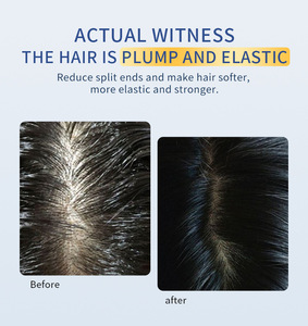 Minyak Rambut Organik Rosemary Kelapa Alpukat untuk Pertumbuhan Anti-Rontok Perawatan Penguatan dengan Minyak Esensial untuk Pria & Wanita 150ml - Product Image 2