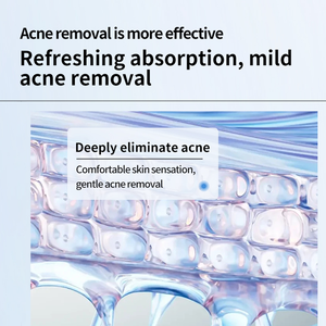 Chuyên Nghiệp Nhẹ Mụn Trứng Cá Loại Bỏ Cải Thiện Da Gel Kem Tứ Xuyên Tiêu Tinh Chất Khai Thác Mặt Kem Dưỡng Da Cho Loại Bỏ Mụn Trứng Cá - Product Image 6