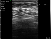 Échographe portable couleur GREAT FARM 3 en 1 pour clinique vétérinaire, échographie clinique pour vache, cochon, échographie couleur B