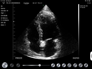 Konted MDR mesin <span class=keywords><strong>Ultrasound</strong></span> nirkabel, pemindai <span class=keywords><strong>Ultrasound</strong></span> nirkabel teknologi tinggi untuk jantung/Hati - Product Image 5
