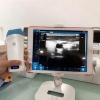 Échographe vétérinaire sans fil à sonde intégrée pour le diagnostic de gestation des porcs, des moutons, des chèvres et des bovins pour les exploitations d'élevage