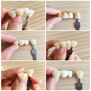 Bloc de céramique en zircone à <span class=keywords><strong>d</strong></span>égradé de couleur naturelle haute résistance pour fraisage dentaire CAD/CAM, couronnes, bridges et facettes - Product Image 3