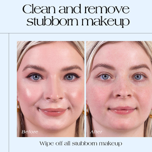 Twg Rts New Arrivals 300Ml Hồng Trang Điểm Remover Nước Với Đầu Bơm Tự Nhiên Nhẹ Nhàng Làm Sạch Đôi Mắt Đôi Môi Mặt Rose Micellar Nước - Product Image 5