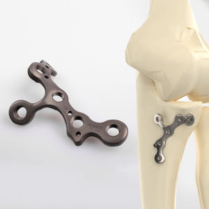 CANWELL Proximal Ulnar pelat pengunci <span class=keywords><strong>T</strong></span> TItanium, pemasok CE ISO perbaikan tulang implan ortopedi Volar pergelangan tangan - Product Image 1