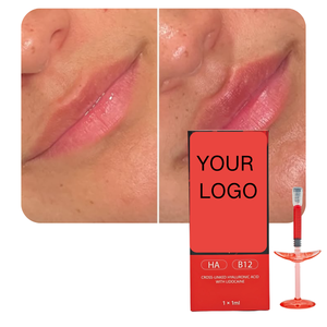 Long Lasting 1ml Vitamin B12 Red <strong>Lip</strong> Gel, Aesthetic <strong>Lip</strong> Shaping Volume <strong>Filling</strong>, Factory Direct Wholesale - Product Image 4