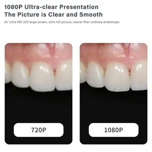 24 pulgadas pantalla táctil Windows 10 cámara intraoral dental con monitor