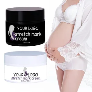 تسمية خاصة الطبيعي إصلاح مكافحة Vergeture تمتد علامات كريم علامة تمتد كريم إزالة ل إصلاح ندبة الحمل