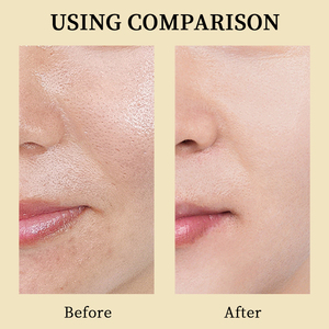 Private Label Low MOQ Organic oleoso per la pelle viso idratante sbiancante Acne aminoacidi viso schiuma detergente - Product Image 4