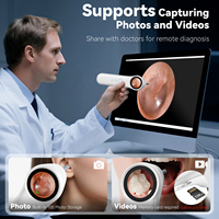 Caméra d'oreille intelligente visible Q13, appareil de nettoyage du conduit auditif numérique 1080P, otoscope numérique pour toute la famille