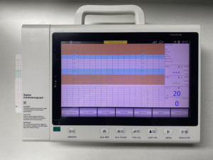 Máquina de Cardiotocografía Eléctrica de Fábrica China, Monitor Fetal Portátil para Gemelos, Certificado CE ISO - Product Image 5