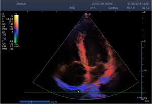 เครื่องอัลตราซาวนด์ Sonoscape S9 S9V S8 S8exp แบบพกพา พร้อมระบบ Color Doppler และหน้าจอสัมผัสขนาด 13.3 นิ้ว สำหรับใช้ในสัตว์และมนุษย์ - Product Image 6
