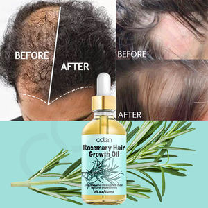 Bán buôn OEM kích thích tăng trưởng tóc giảm rụng tóc hữu cơ tăng trưởng tóc dầu hương thảo - Product Image 4