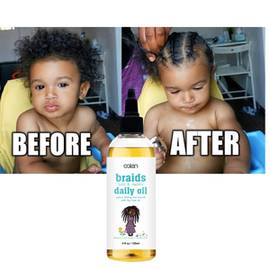 Aceite Capilar Luxfume para Niños, Humectante <span class=keywords><strong>con</strong></span> Vitaminas Herbales para <span class=keywords><strong>el</strong></span> Crecimiento, Loción para Peinar para Bebés, Niños Pequeños y Niños Negros - Product Image 6