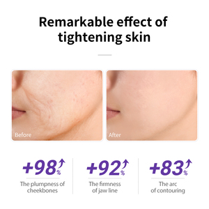 เซรั่มบำรุงผิวหน้า LANBENA ลดเลือนริ้วรอย ยกกระชับ ฟื้นฟูผิว 30 มล. (ขายส่ง) - Product Image 6