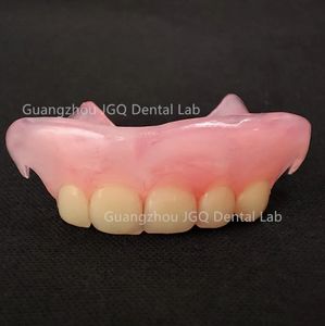 <span class=keywords><strong>Prothèse</strong></span> <span class=keywords><strong>dentaire</strong></span> flexible Valplast <span class=keywords><strong>Prothèse</strong></span> <span class=keywords><strong>temporaire</strong></span> sans meulage des dents, pilier invisible, esthétique, opération facile et rapide - Product Image 5