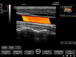 Sistem <span class=keywords><strong>Ultrasound</strong></span> profesional PT50A/C: menggabungkan portabilitas, pencitraan Digital penuh, dan kinerja yang andal. - Product Image 5