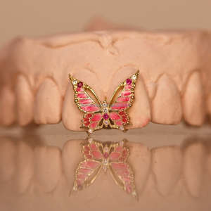 Rose émail papillon Grillz filles visage ouvert femmes mignonnes <span class=keywords><strong>haut</strong></span> <span class=keywords><strong>avant</strong></span> <span class=keywords><strong>dent</strong></span> rose Moissanite diamant S925 argent or dents Grillz - Product Image 1