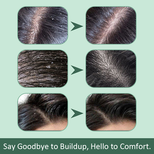 สครับทำความสะอาดหนังศีรษะสมุนไพรผสมเกลือทะเลและน้ำมันโจโจ้บา แชมพูขจัดสิ่งสกปรกและผลัดเซลล์ผิวอย่างล้ำลึกสำหรับทุกสภาพเส้นผม (283.5 กรัม) - Product Image 2