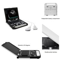 Ecógrafo Portátil 3D 4D, Sistema de Ultrasonido Doppler para Uso en Fisioterapia, Musculoesquelético y Vascular