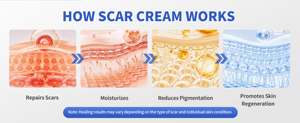 Crema de Silicona para Eliminar <span class=keywords><strong>Cicatrices</strong></span>, Gel de Silicona para <span class=keywords><strong>Cicatrices</strong></span>, Venta al Por Mayor - Product Image 5
