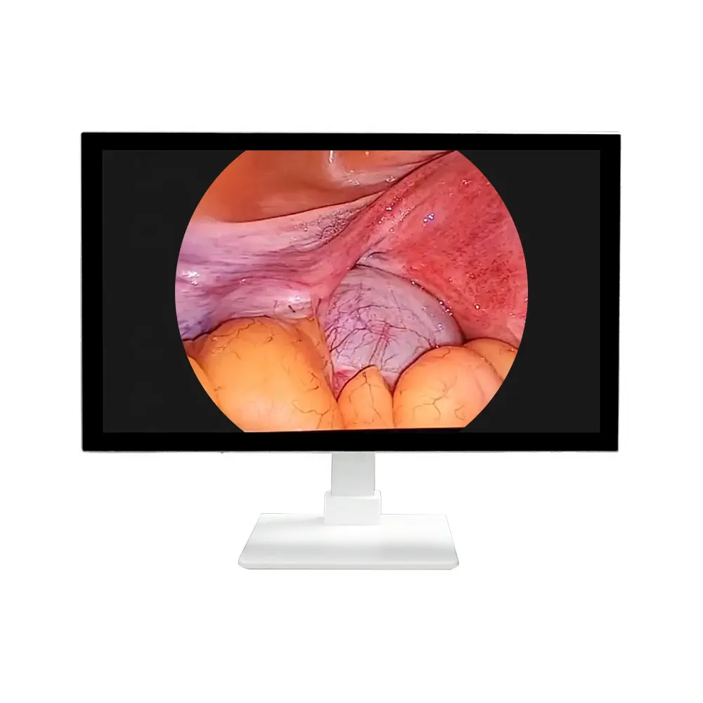 32 Inch Endoscope Camera Monitor for Medical Surgery