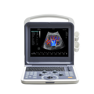 Equipo médico obgyn 4d color <span class=keywords><strong>doppler</strong></span> ultrasonido portátil máquina de <span class=keywords><strong>eco</strong></span> color <span class=keywords><strong>doppler</strong></span> Ultrasonido - Product Image 1