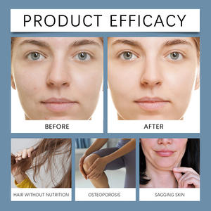 Supplément Protéine d'Acide Hyaluronique Super OEM Supplément Poudre Usine Vente en Gros Booster de Collagène <span class=keywords><strong>Anti</strong></span>-âge <span class=keywords><strong>Nutrition</strong></span> de Beauté pour Adultes - Product Image 3