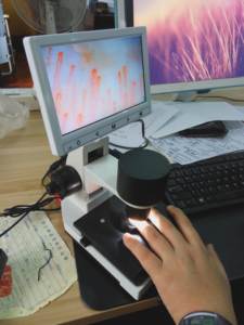 네일 폴드 모세혈관경 공장 가격/비디오 모세혈관경 가격 - Product Image 3