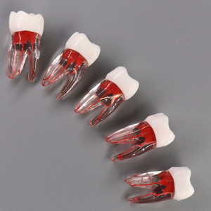 Pratica dentale utilizzando il modello di dente per il trattamento endodontico Root Ca <span class=keywords><strong>nal</strong></span> - Product Image 4