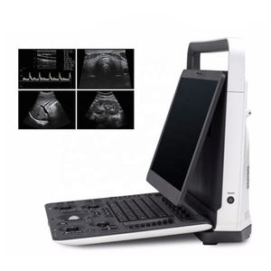 SonoScape E2 Ultrasonik Kualitas Tinggi dengan Sensor Ultrasonik - Product Image 1