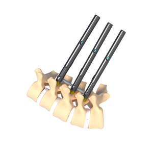 Vite pedicolare universale in titanio di alta qualità a passo variabile, a coda corta, per impianto ortopedico Miko II, per operazioni manuali sulla colonna vertebrale - Product Image 3