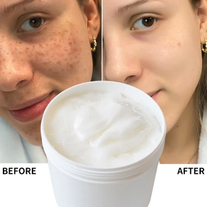 Crema antirughe all'ingrosso da 1 kg con proteine del collagene per la riparazione della pelle e anti-invecchiamento. Crema sbiancante per il viso semilavorata OEM. - Product Image 1