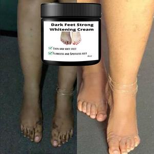 Crème Éclaircissante Action Rapide pour <span class=keywords><strong>Pieds</strong></span> Foncés Crème Éclaircissante Extrême pour <span class=keywords><strong>Pieds</strong></span> Sombres - Product Image 4
