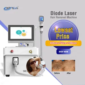 Professional USA CE FD approved super 755 808 1064 diode laser hair removal machine 808 for face and body