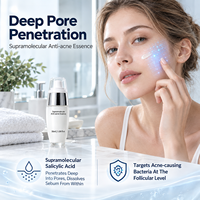 Sérum Traitant Personnalisé à l'Acide Salicylique Supramoléculaire pour l'Acné, Contrôle du Sébum et Hydratation