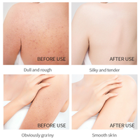 OEM Arbutin Sugar Scrub Exfoliating and Chicken Skin Removing Bath Salt Scrub