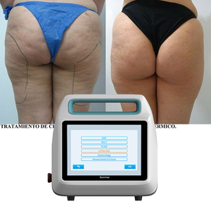 Equipo Portátil de Endolifting Láser de Alta Potencia 980nm 1470nm 50W para Liposucción y Eliminación de Grasa - Product Image 1