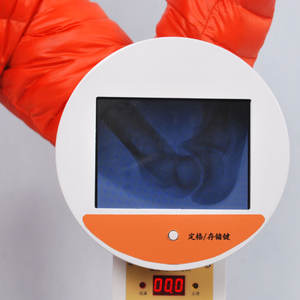 جهاز أشعة سينية طبي محمول على شكل حرف C للتشخيص بسعر تنافسي - Product Image 3