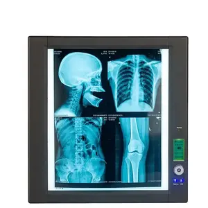 Ziekenhuis Dubbele Led X-Ray Viewer Lichtbak Voor Medische Film Of X Ray Film