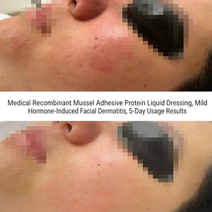 Suero Reparador Facial Orgánico de <span class=keywords><strong>Mejillones</strong></span> para Reparación de Daños Faciales Después de Microneedling, Venta al Por Mayor - Product Image 6