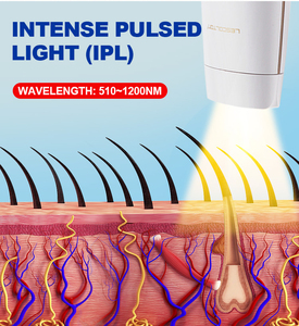Dispositivo de depilación láser 2024 Ipl, <span class=keywords><strong>depiladora</strong></span> láser de punto eléctrica portátil profesional de larga duración en el hogar para mujeres y hombres - Product Image 4