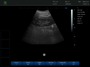 Scanner à ultrasons MY-A009A-B, scanner à ultrasons noir et blanc, appareil à ultrasons vétérinaire portable - Product Image 5
