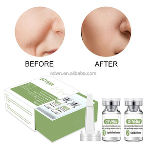 2023 Neueste Fibronectin Lyophilized Powder Repair Serum Anti-Aging Anti-Falten Akne Mark Skin Repair Lyophilized Powder - Product Image 2