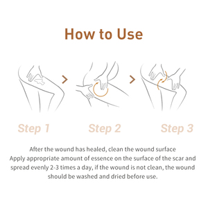 Huyết Thanh LANBENA Trị Sẹo, Huyết Thanh Loại Bỏ Mụn Đen Và Vết Rạn Da - Product Image 3