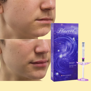Production personnalisée en lot, combleur profond qui allonge le menton et sculpte les contours du visage, livraison gratuite <span class=keywords><strong>des</strong></span> produits - Product Image 3