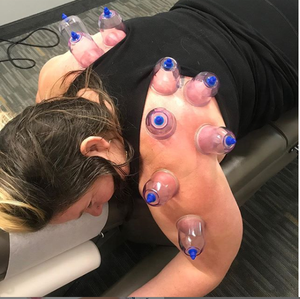 Ensemble de ventouses en plastique 13 pièces pour <span class=keywords><strong>massage</strong></span> d'acupuncture chinoise du corps avec traitement d'aspiration Ensemble de ventouses - Product Image 6
