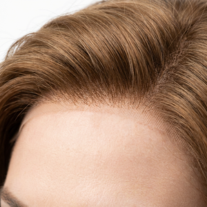 Perruque de luxe 100 % cheveux humains tissés à la main avec dentelle HD, perruque respirante de qualité médicale pour femmes souffrant d'<span class=keywords><strong>alopécie</strong></span> - Product Image 4